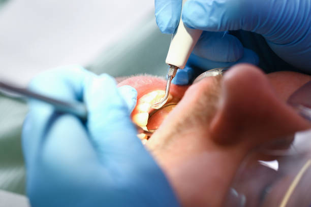 Best Same-Day Emergency Dental Services in Palmview South, TX